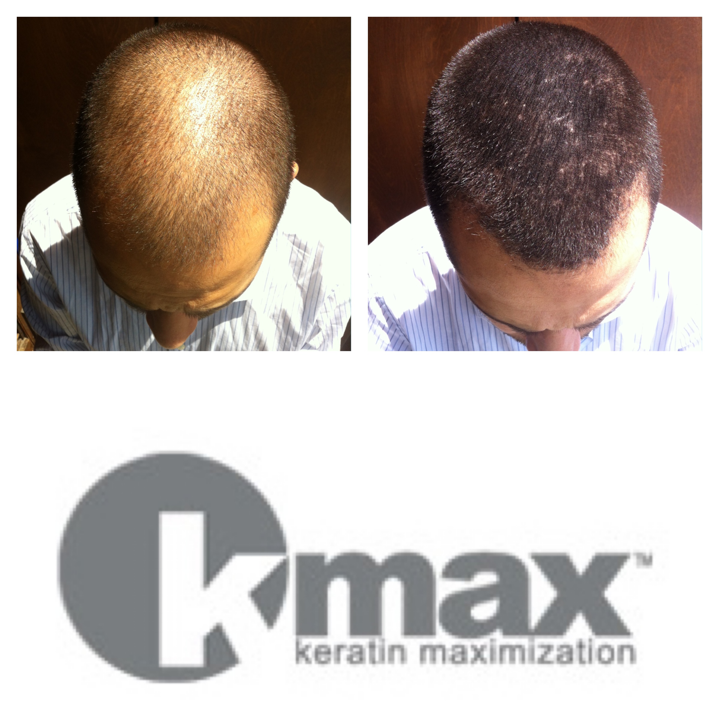 kmax microfibras de queratina